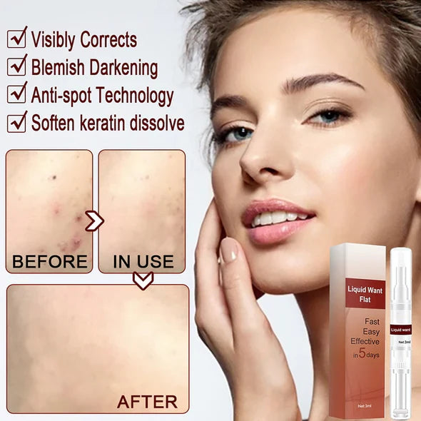 WIPEOFF™ TAGS & MOLES REMOVER