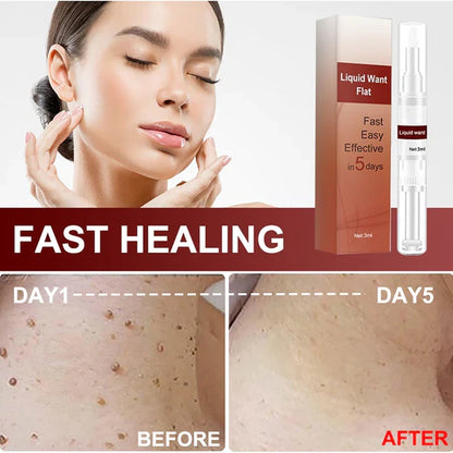 WIPEOFF™ TAGS & MOLES REMOVER